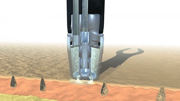 How Silk Infusion works animation
